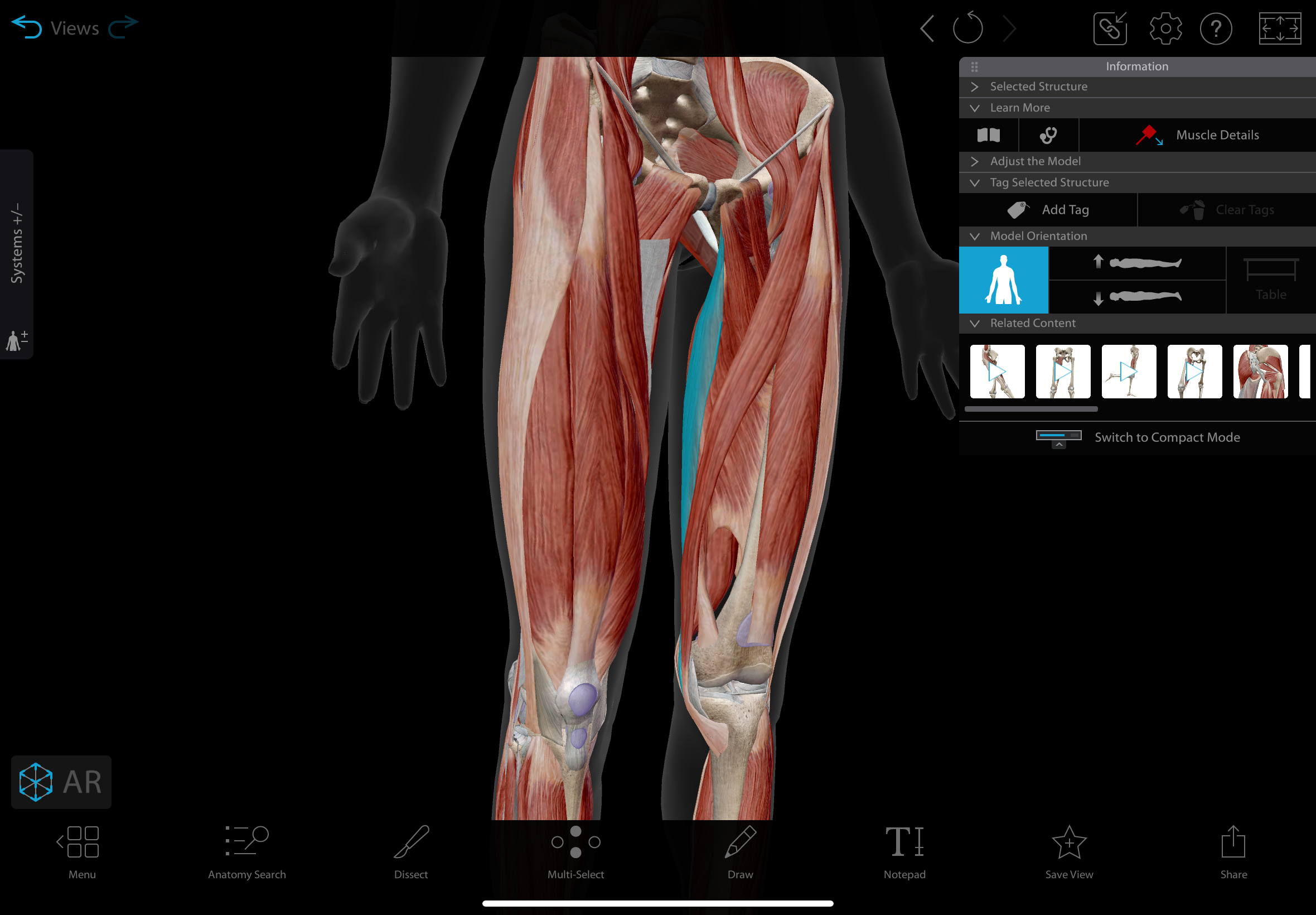 <p>A long, thin muscle in the medial thigh </p><p></p><p>actions: hip: adduction, medial rotation, knee: flexion, medial rotation</p><p>innervation: obturator nerve </p>
