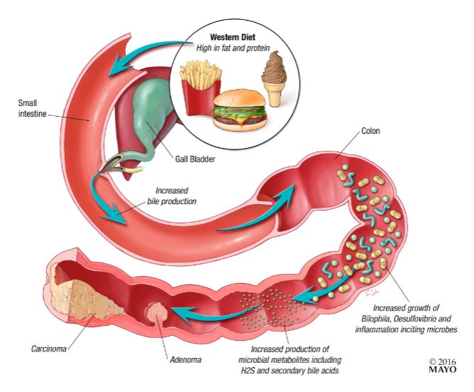 <p>Look for the audio that describes this. Just know that eating bad food or basically what microbes don&apos;t like to eat will eventually cause carcinoma,</p>