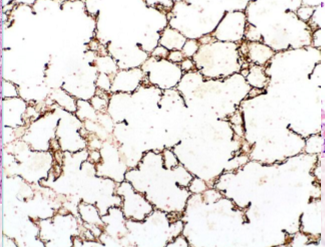 <p>Von kossa - black. </p>