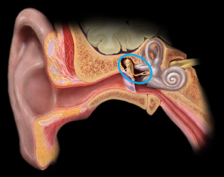 <p>Middle ear<br>A chain of 3 bones (malleus, incus, and stapes) that connect the tympanic membrane to the oval window.</p>