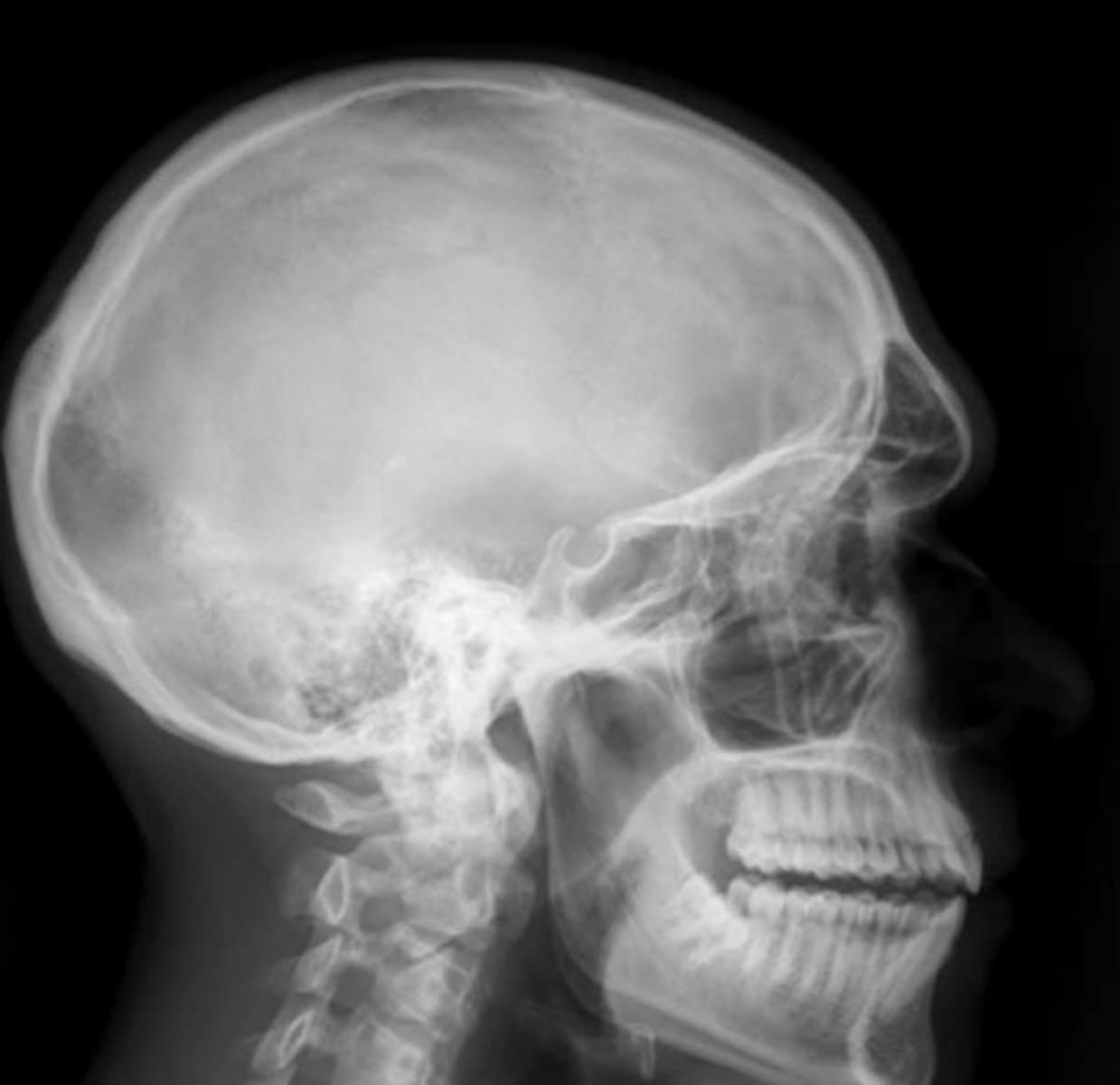 <p>What position/projection?</p>