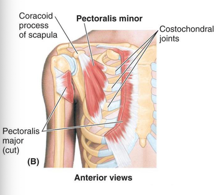 <p>A: </p><ul><li><p>fixed origin: tilt scapula anteriorly</p></li><li><p>fixed insertion: elevate ribs to assist inhalation</p></li></ul><p>N: medial pectoral nerve; C7, C8</p>