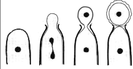 <p>enteroblastico</p>
