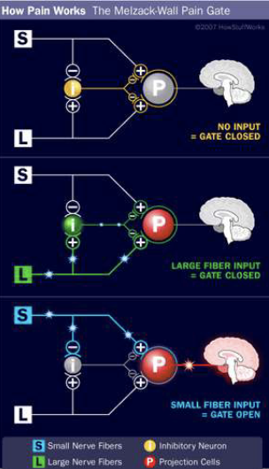 <p>what is gate control theory?</p>