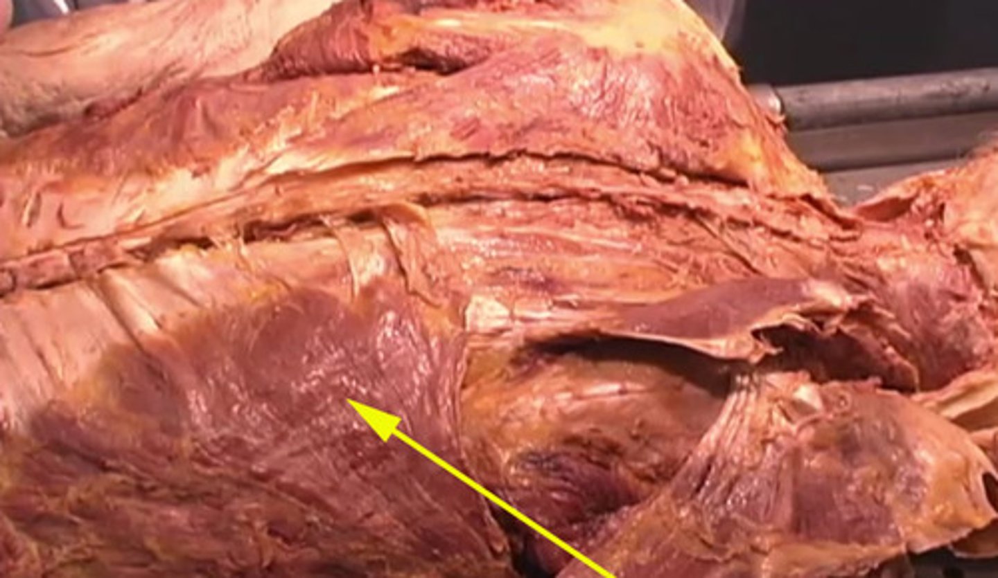 <p>What structure is being shown here with the pointer?</p><p>rib</p><p>lateral oblique</p><p>latissimus dorsi</p><p>spine</p>