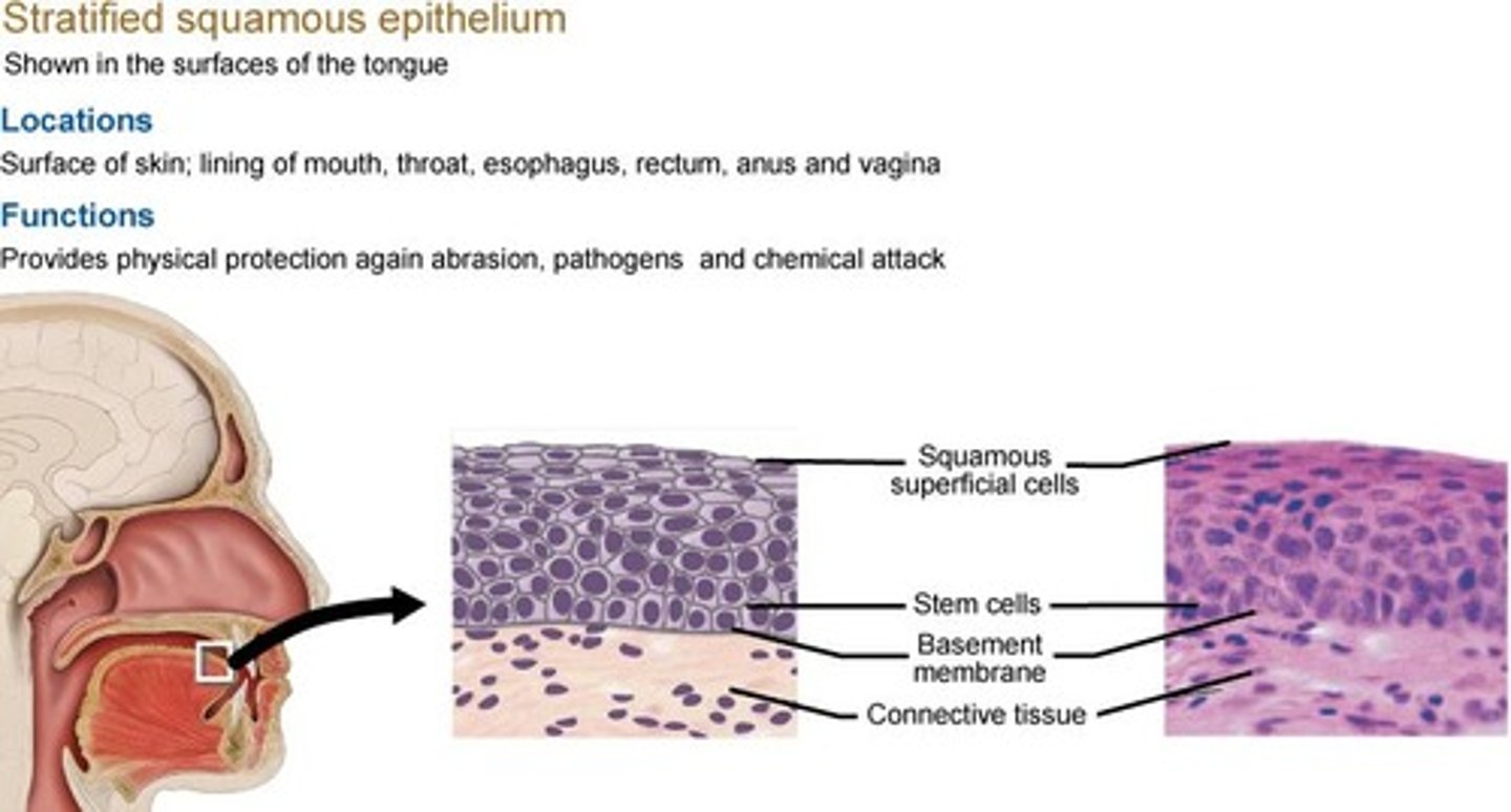 <p>Forms the epidermis; found in oral cavity, esophagus and vagina.</p>