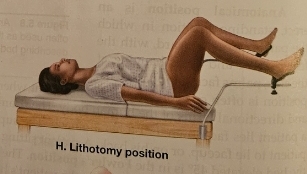 <p>Lithotomy Position</p>