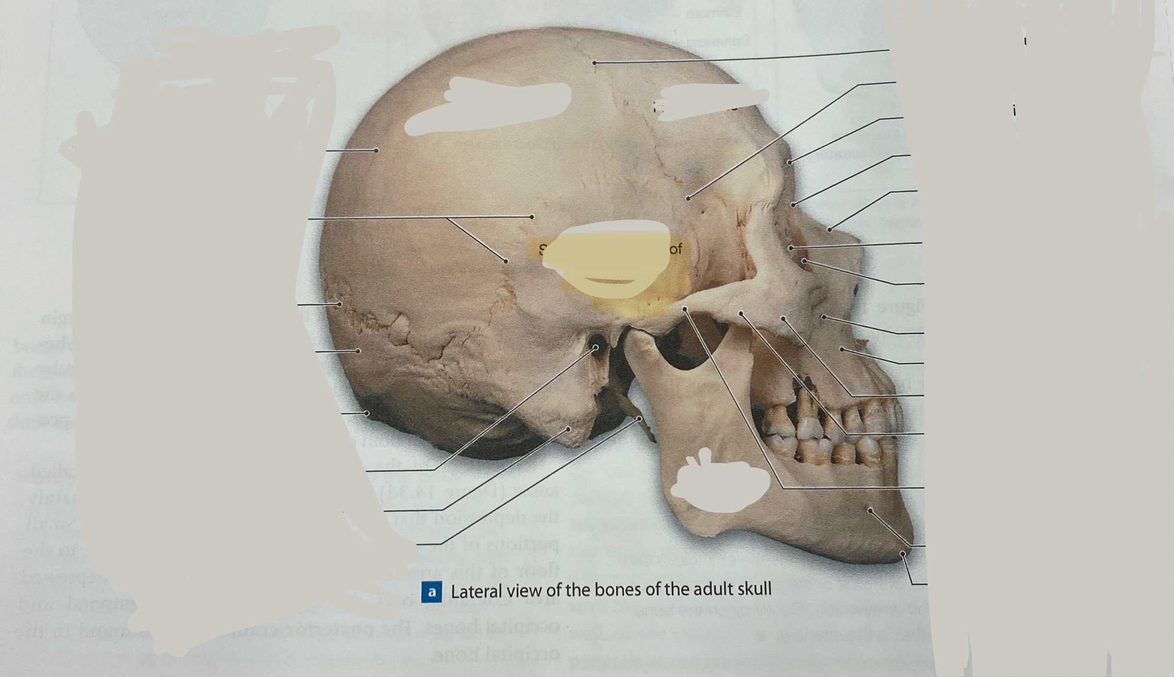 <p>what bone is this?</p>