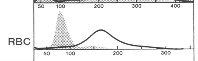 <p>what type of RBCs do you expect on a smear?</p>