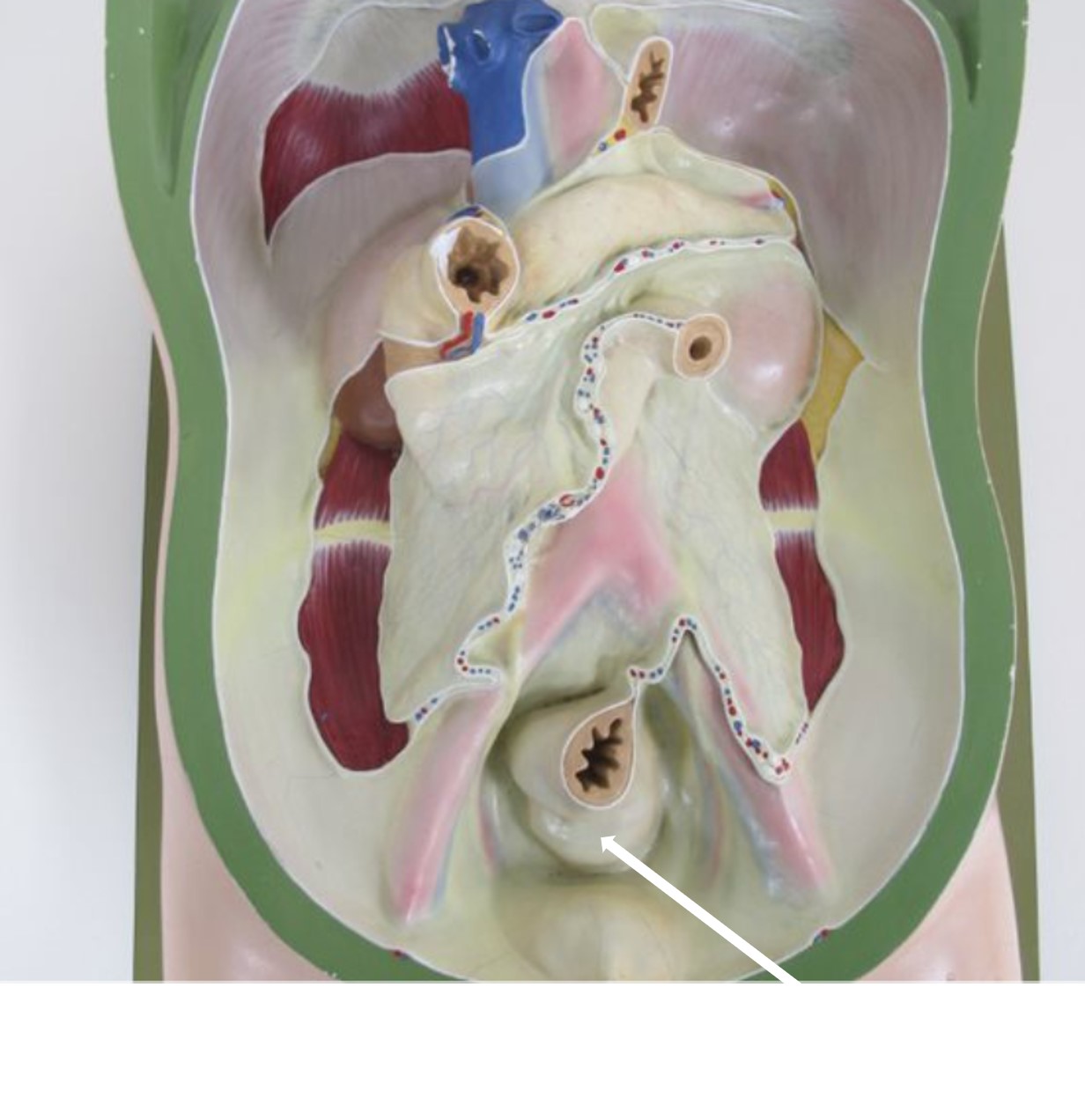 <p>orgaan bedekt met parietaal peritoneum</p>
