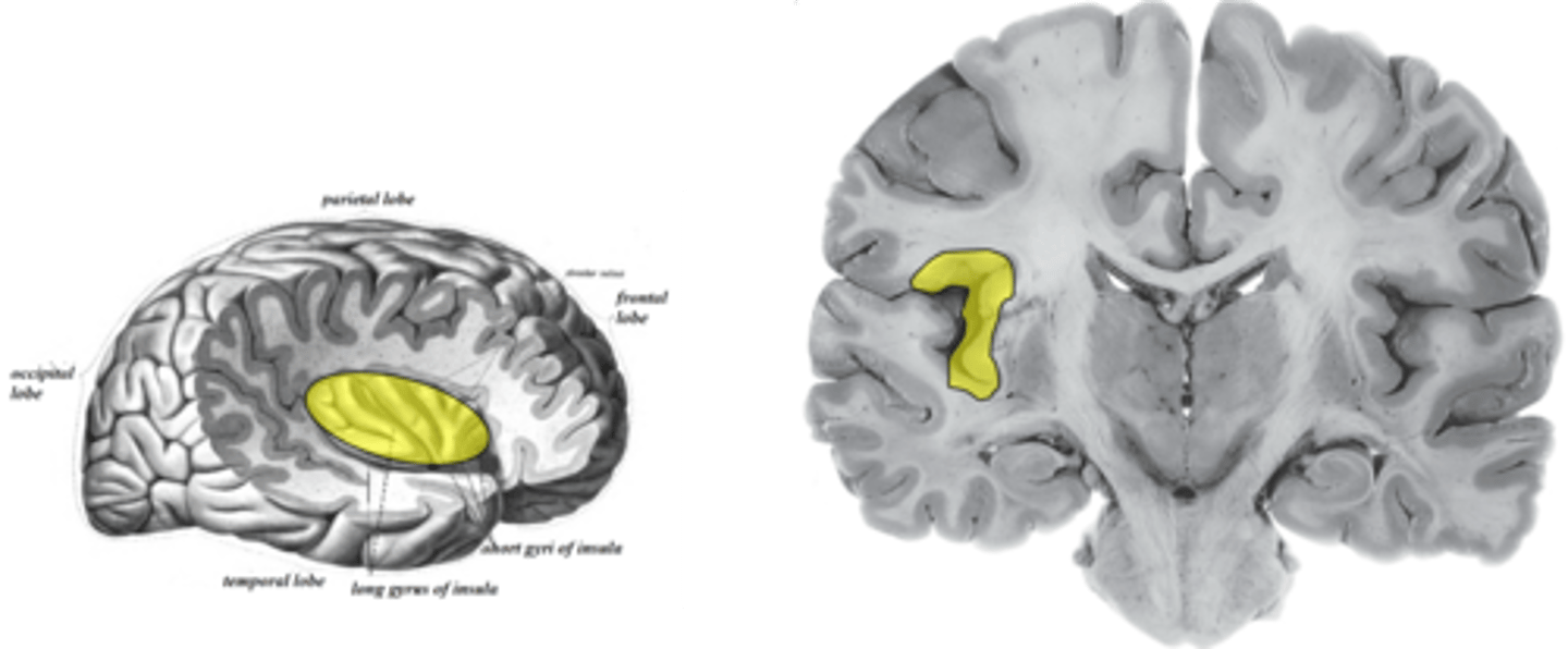 <p>1. SVAs conveying taste</p><p>2. GVAs conveying visceral pain;</p><p>important for conditioned taste aversion (teaching the consumer to avoid potentially dangerous food)</p>