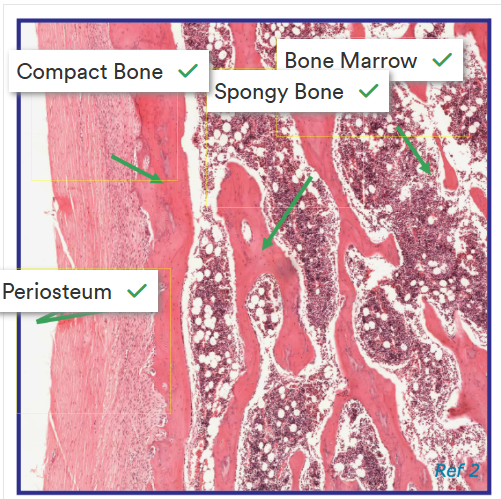 <p>Image for identifying regions of a bone</p>