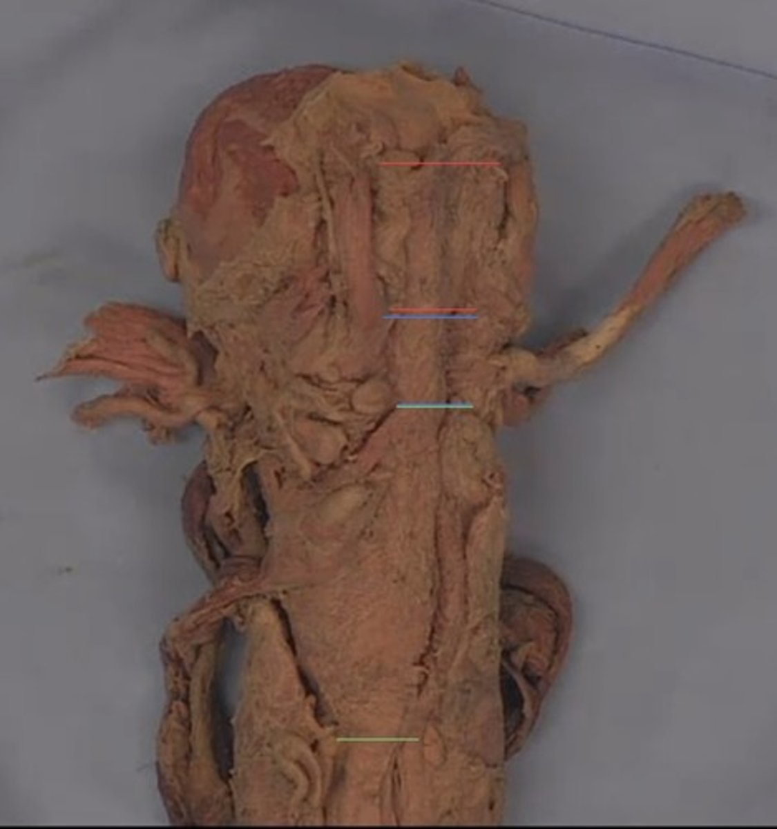 <p>What is the structure outlined in red?</p>