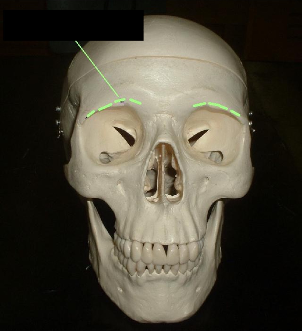 <p>around the top of the eye socket; edge; eyebrow bone</p>