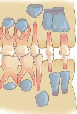 <p>Permanent teeth that replace primary teeth (incisors, canines, premolars)</p>