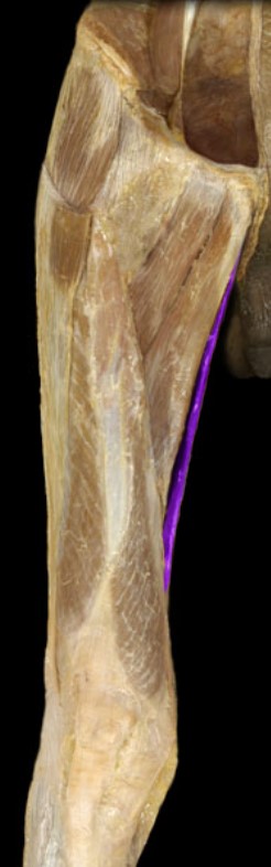 <p>Name the muscle highlighted (one word - all lowercase)</p>