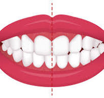 <p>Midline </p>