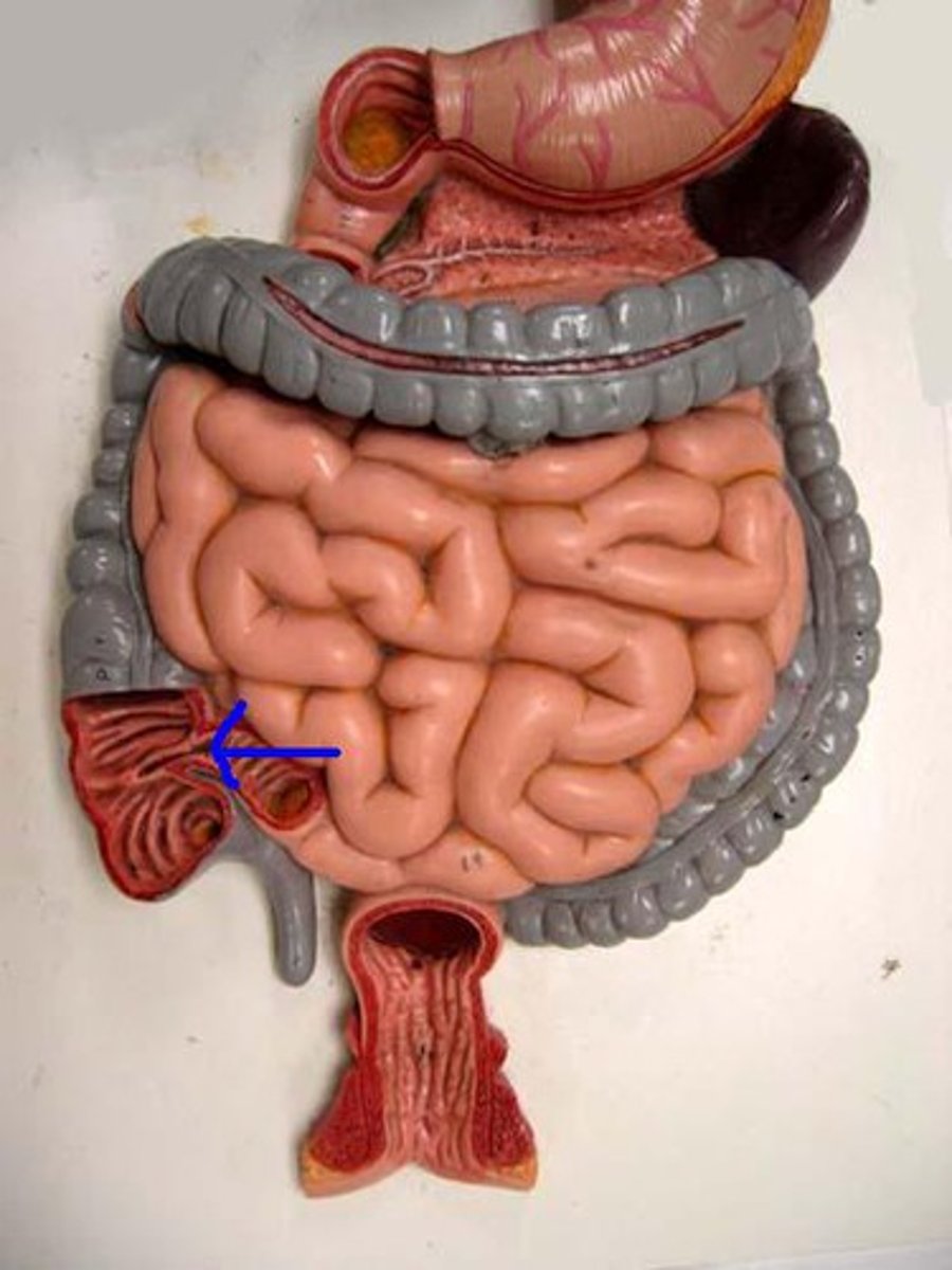 <p>In right lower quadrant where terminal ileum enters cecum.</p>