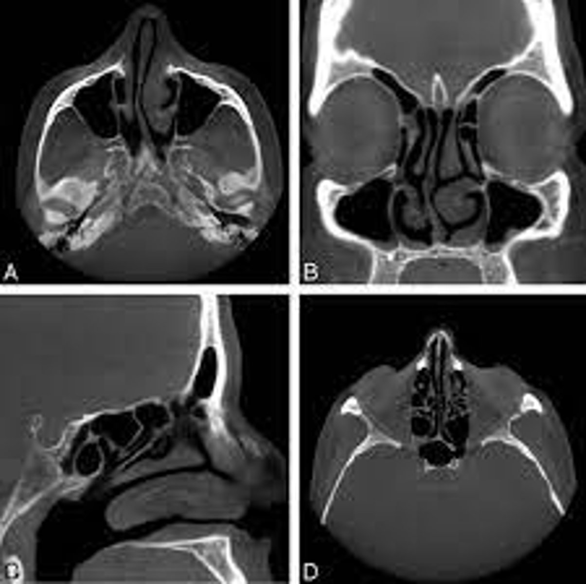 <p>ID the type of Imaging modality:</p><p>- Pano</p><p>- CT</p><p>- CBCT</p><p>- MRI</p><p>- Technetium 99 bone scans</p><p>- PET</p>