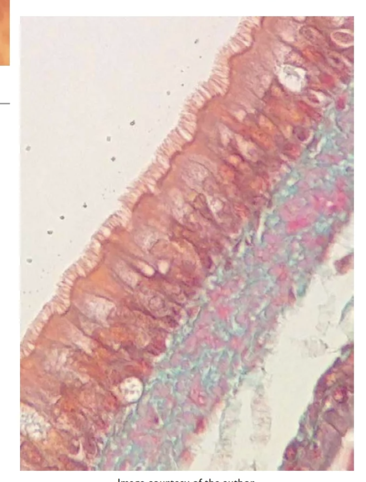 <p>Pseudostratified columnar epithelium</p><p></p>