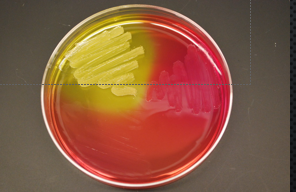 <p>mannitol salt agar</p>