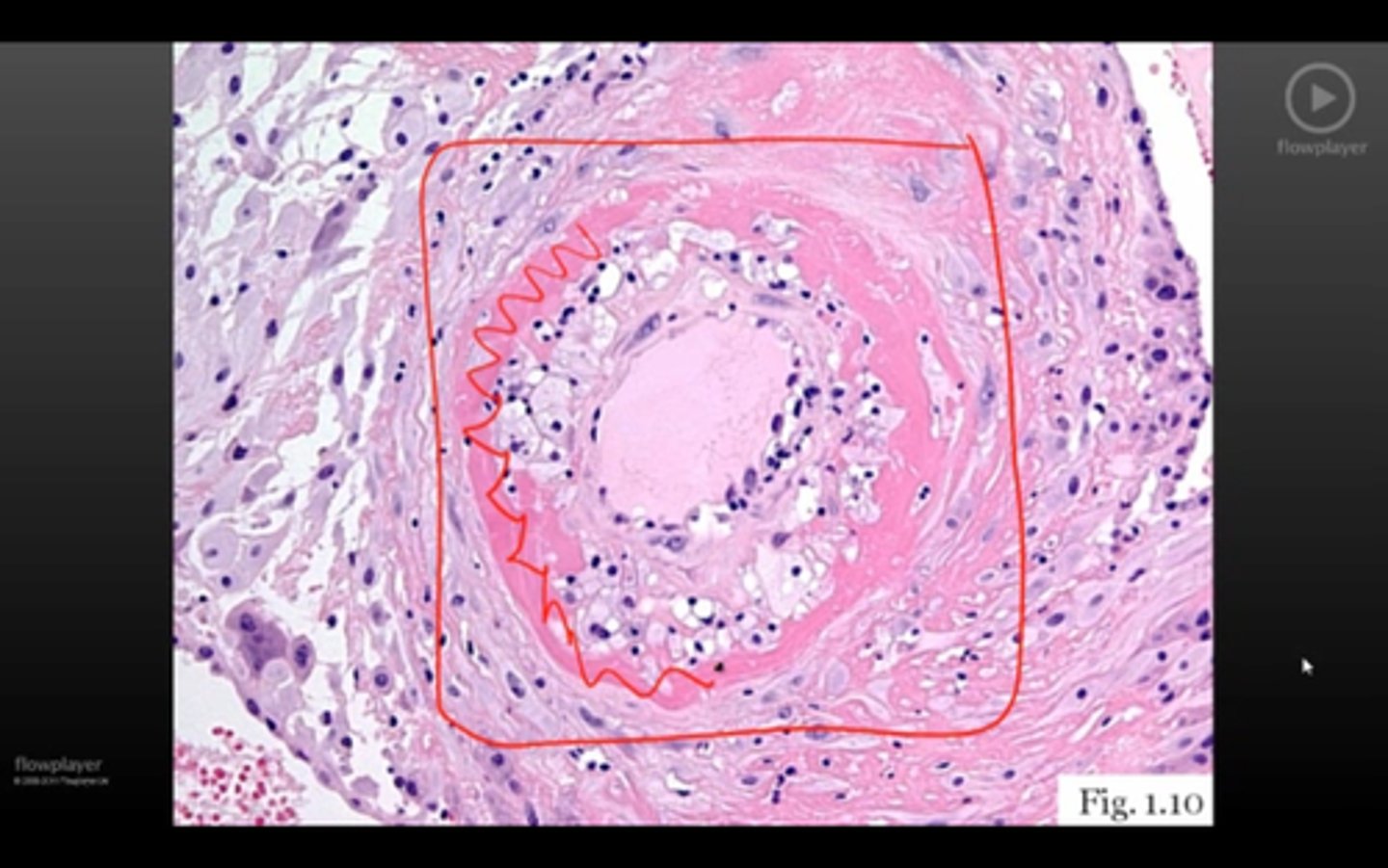 <p>notice pink stain</p>