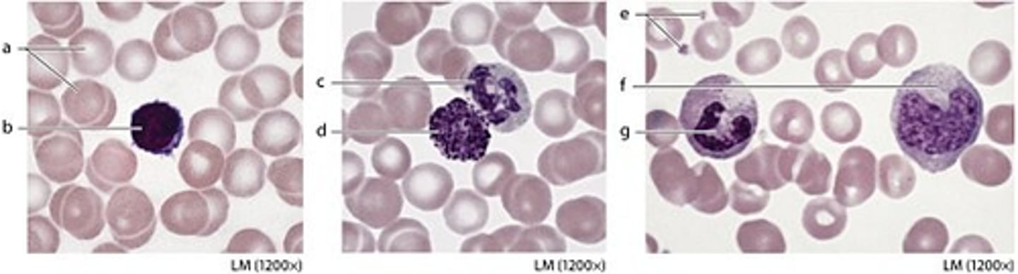 <p>platelet</p>