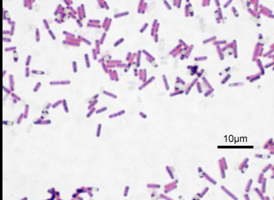 <p>What is the shape of this bacteria</p>