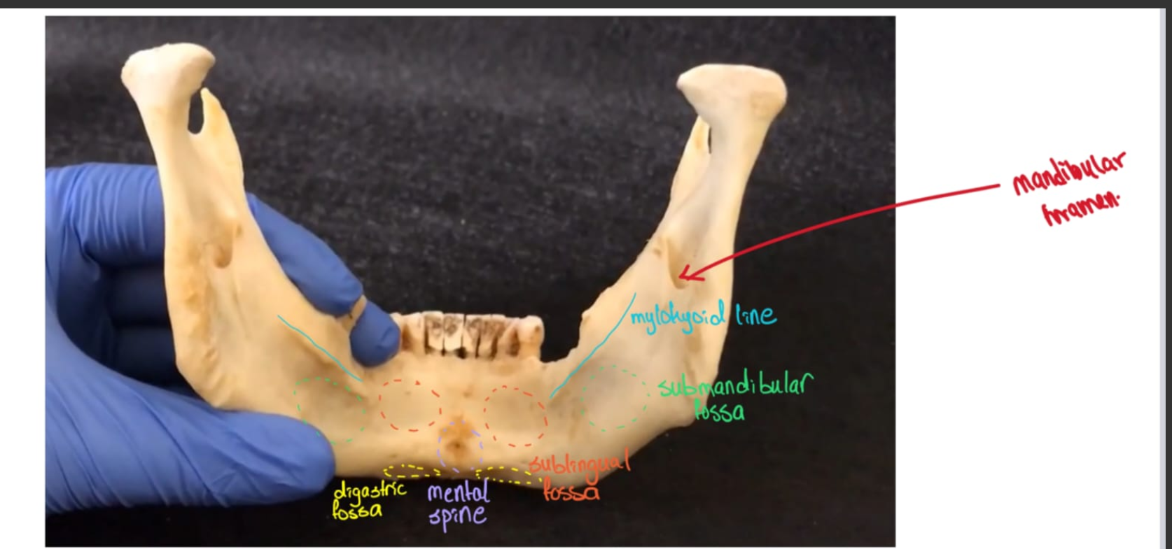 <p>Digastric fossa</p>
