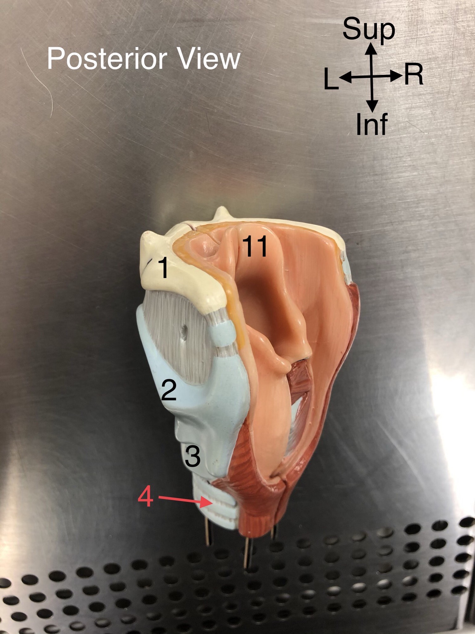 <p>11. A flap of cartilage that covers the windpipe during swallowing. </p>