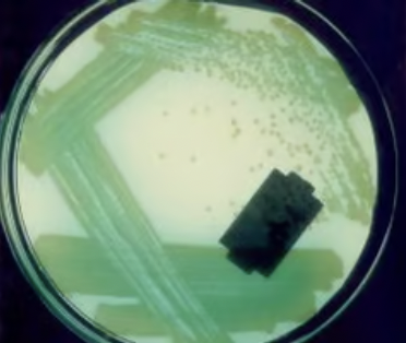 * similar to coliform but often form yellow-green, green, or blue-green pigment
* gram negative
* fairly common, can produce severe infections, especially in burn patients