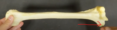 <p><span>*anterior view</span></p>