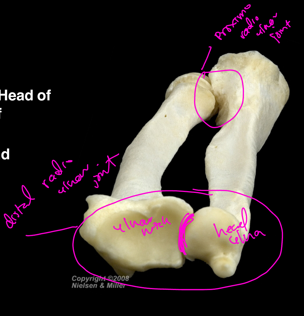 <p>Synovial joint; Articulation of the head of ulna and ulnar notch of radius; allows for pronation and supination of forearm.</p>
