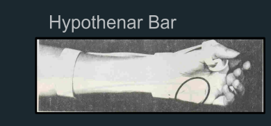 <p></p>