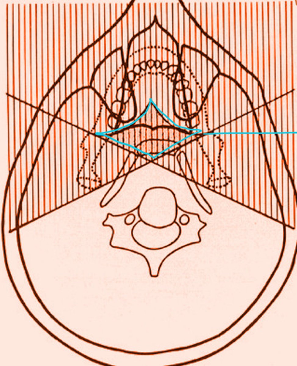 <p>the shaded region within the blue diamond will produce a total of __ images</p>