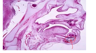 <p>-disappears in most places without replacement</p><p>-undergoes endochondral ossification- contributes to bone of mandible and incus/malleus/stapes</p><p>-in anterior and middle segments, chondrocyte hypertrophy and atypical ECM calcification then resorption (no bone replacement!)- unique for Meckel’s cartilage</p><p>-between middle and posterior segments, apoptosis of non-hypertrophic chondrocytes and degradation of non-mineralized ECM by MT1-MMP</p>
