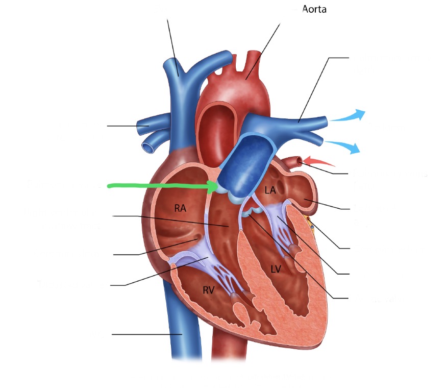 <p>Between right ventricle and pulmonary trunk; prevents backflow into right ventricle.</p>