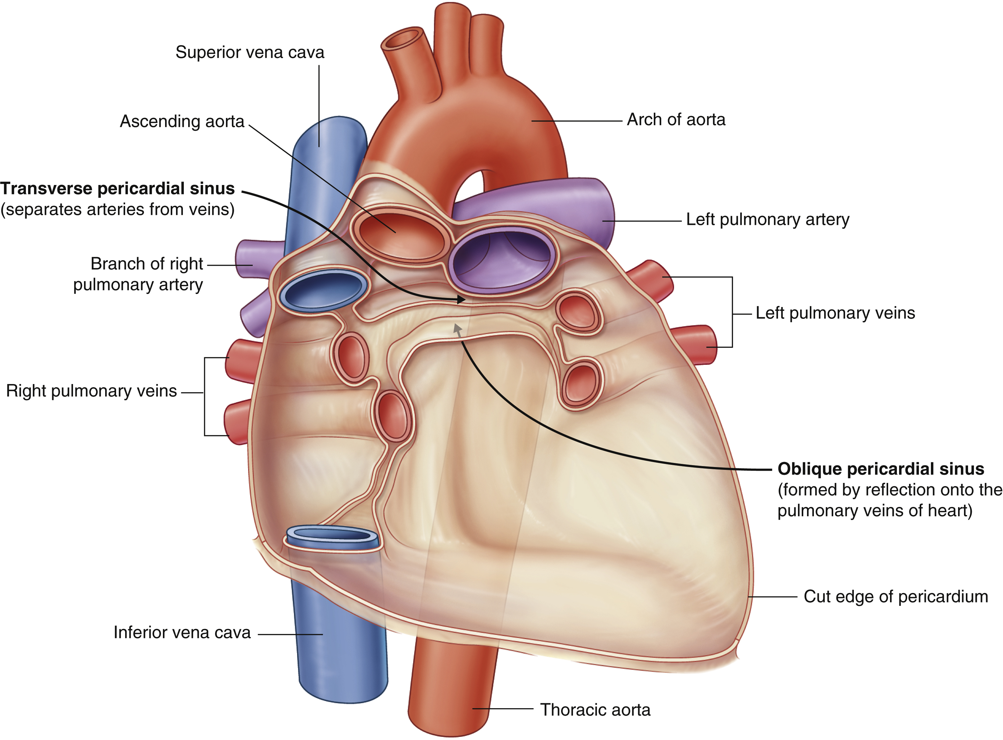 <p>oblique pericardial sinus</p><p>(impressions in the pericardial sac formed between the points where great vessels enter it)</p><p>Located <u>posterior</u> to the left atrium; between R and L pulmonary veins</p><p>No clinical significance.</p>