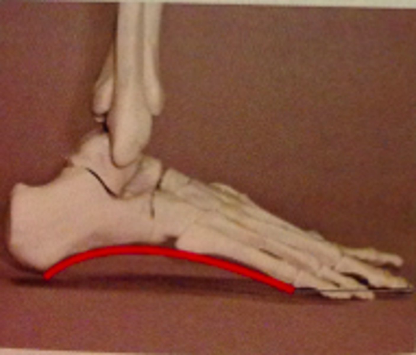 <p>-Extends between little to and the heel</p><p>-Formed from calcaneus, cuboid bones, metatarsals IV and V</p>
