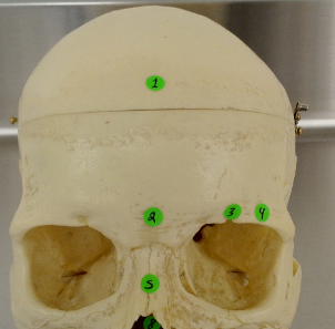 <p>#4 right above eye sockets and below brow ridge - provides shield for eyes</p>