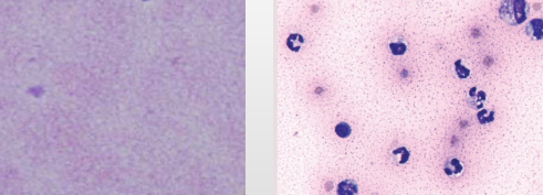 <p>Body cavity effusions</p><p>What is this?</p><p>Why?</p>