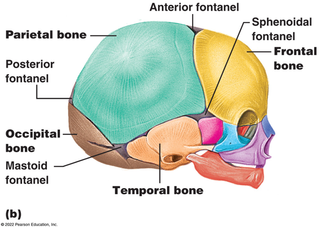 <p><span><span>In newborns and infants, the areas of connective tissue between the bones are much wider, especially in those areas on the top and sides of the skull. These broad areas of connective tissue are called&nbsp;</span><strong><span>fontanelles.</span></strong></span></p><p></p><p><span><span>During birth, the fontanelles provide flexibility to the skull, allowing the bones to push closer together or to slightly overlap, aiding movement of the infant's head through the birth canal. </span></span></p><p></p><p><span><span>After birth, these expanded regions of connective tissue also allow for rapid growth of the skull and enlargement of the brain in infancy and early childhood.</span></span></p><p></p><p><span><span> The fontanelles greatly decrease in width during the</span><strong><span> first year</span></strong><span> after birth as the skull bones enlarge and, for most children, are </span><strong><span>closed by age two</span></strong><span>. When the connective tissue between the adjacent bones is reduced to a narrow layer, these fibrous joints are called </span></span><em>sutures</em><span><span>.</span></span></p>
