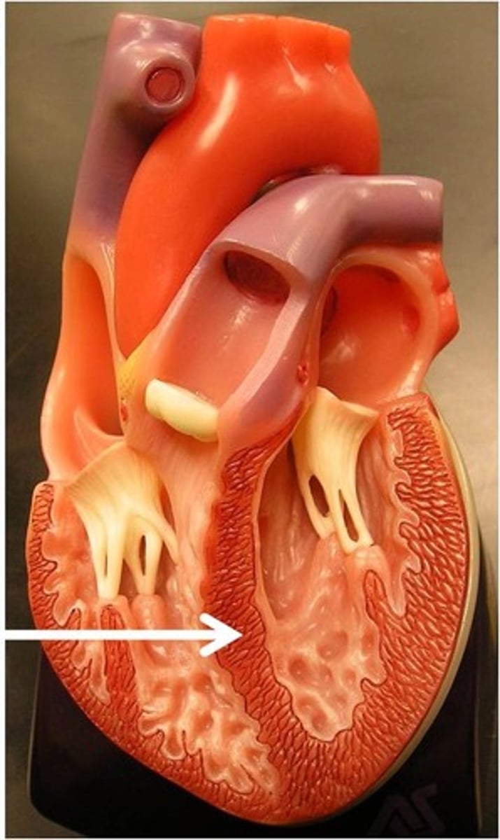 <p>partition between the right and left ventricles</p>