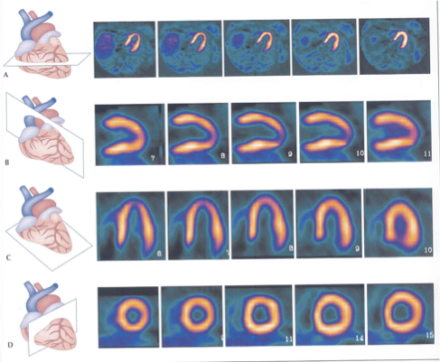 <p>What type of slice is A?</p>