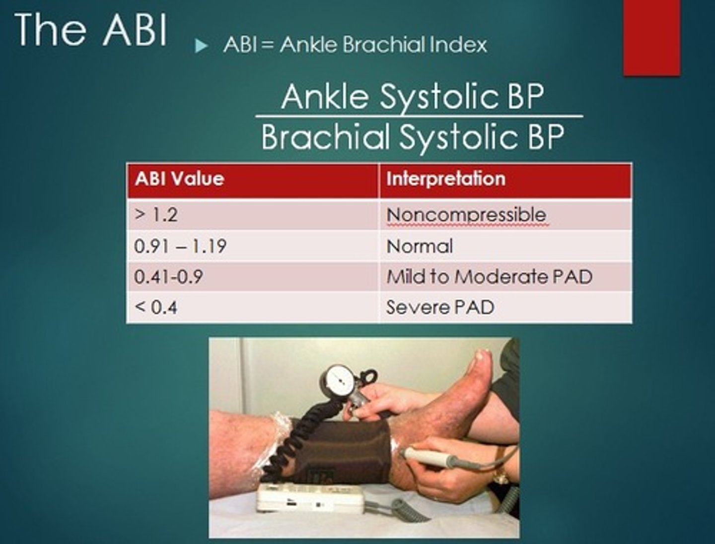 <p>What: ratio of the ankle systolic pressure to the brachial systolic pressure; an objective measurement of arterial disease that provides quantification of the degree of stenosis</p><p>>1.4 = calcified/non-compressible</p><p>1.0-1.4 = normal</p><p>0.9-0.99 = borderline</p><p><0.9 = abnormal</p><p><0.5 = severe arterial dz, risk for ischemia --> refer to vascular specialist</p>