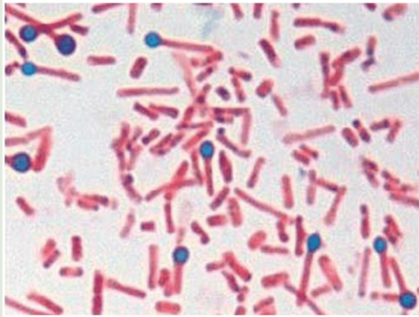 <p>Clostridium tetani</p>