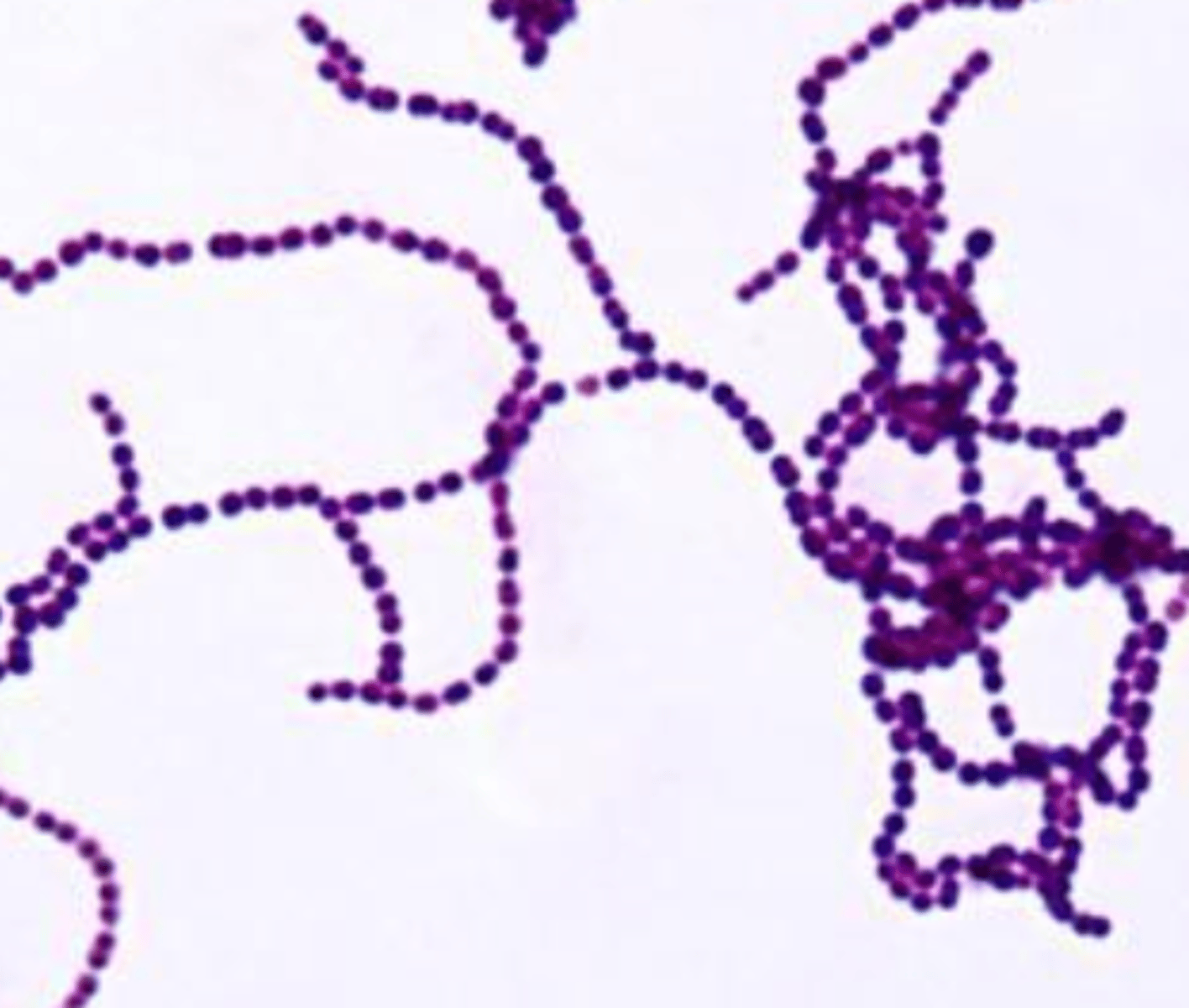 <p>coccus or rods?</p><p>G+ or G-?</p>