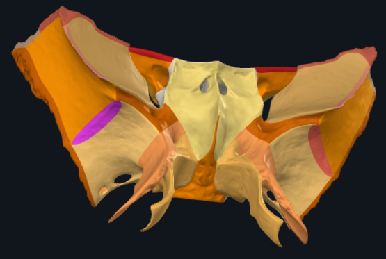 term image