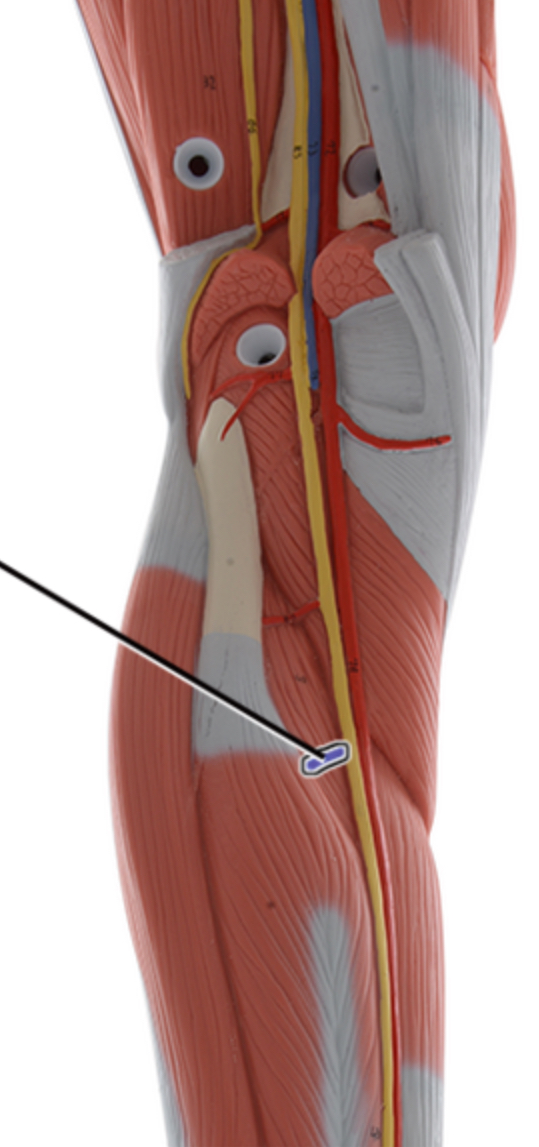 <p>Name this artery.</p>