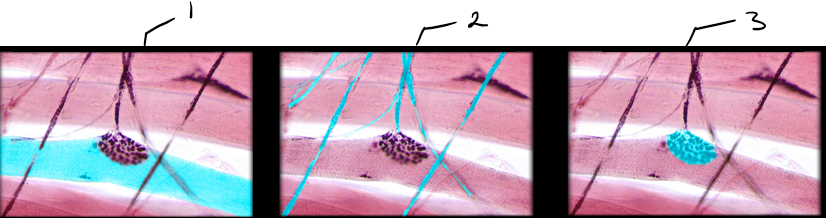 parts of the neuromuscular junction